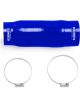 Mishimoto Honda Civic Silicone Induction Hose 2016+ Blue