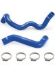 Mishimoto 2016+ Ford Focus RS Silicone Coolant Hoses Nitrous Bl