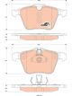 TRW Brake Pads
