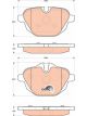TRW Brake Pads