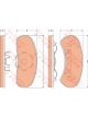 TRW DTEC Brake Pads