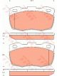 TRW Brake Pads